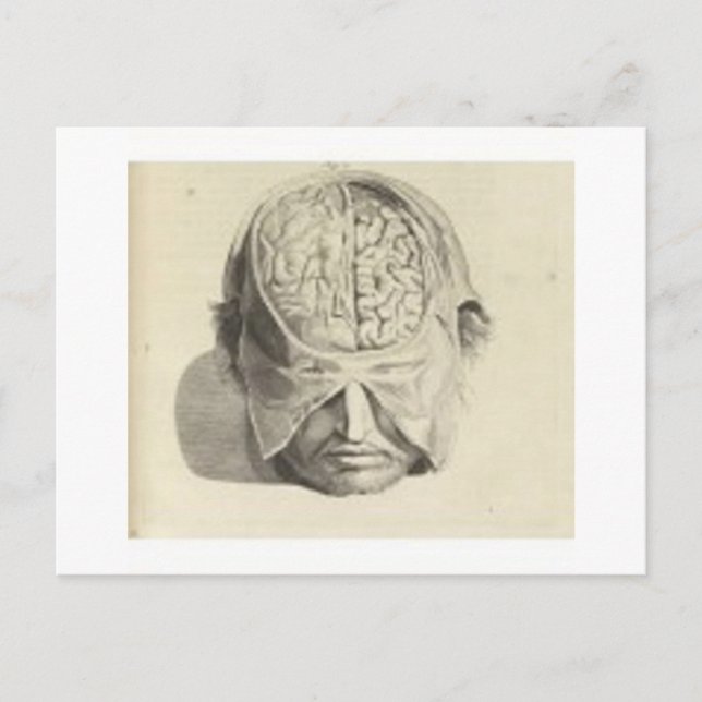 Brains Postcard (Front)