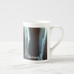 Broken Radius and Ulna Xray "Break Time"   Bone China Mug
