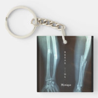 Broken Radius and Ulna Xray "Break Time"