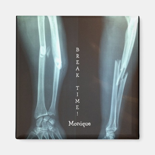Broken Radius and Ulna Xray "Break Time"    Magnet (Front)