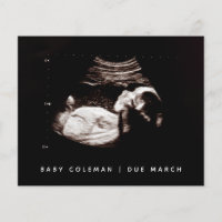 Budget Pregnancy Baby Sonogram Ultrasound Photo