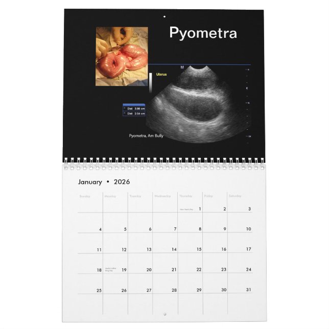 Calendrier des images ultrasoniques (Jan 2026)