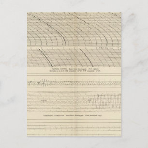 California Seismograms 13 Postcard