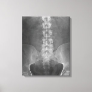 Canevas enrobé d'art numérique à rayons X