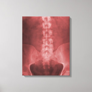 Canevas enrobé d'art numérique à rayons X
