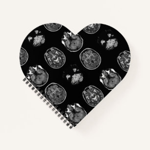 Carnet Analyse IRM du cerveau