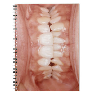 Carnet De photo sanglante peu commune étrange de gommes