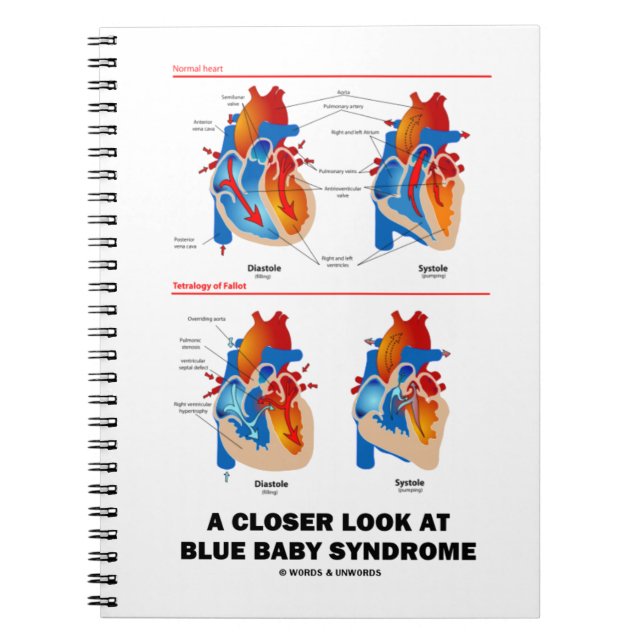 Carnet Un Regard Plus Près Sur Le Syndrome Bleu Du Bébé A (Devant)