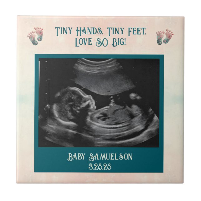 Carreau Baby Ultrasound Keepsaké boîte cadeau (Devant)