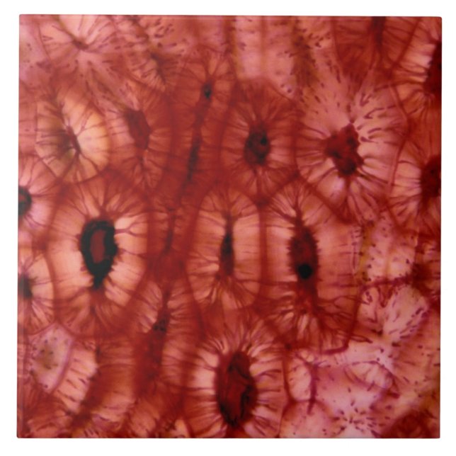 Carreau Cellules de Sclerenchyma d'un puits de cerise (Devant)