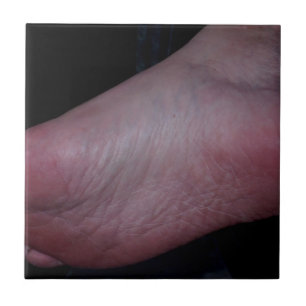 CARREAU DOMME DE PIED