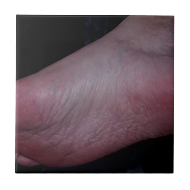 CARREAU DOMME DE PIED (Devant)