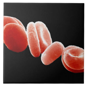 Carreau Globules rouges
