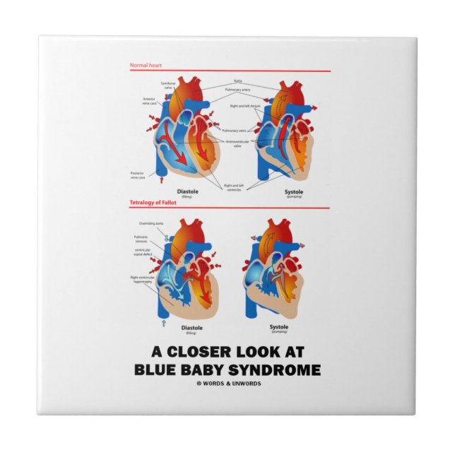Carreau Un oeil plus attentif à l'anatomie de coeur de (Devant)