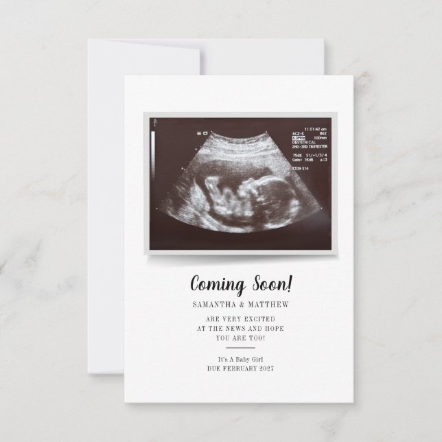 Carte Bientôt Script Ultrasound Photo Grossesse (Devant)