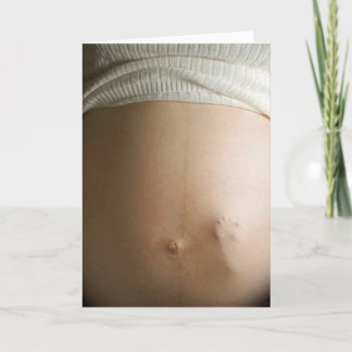 Carte bosse de bébé