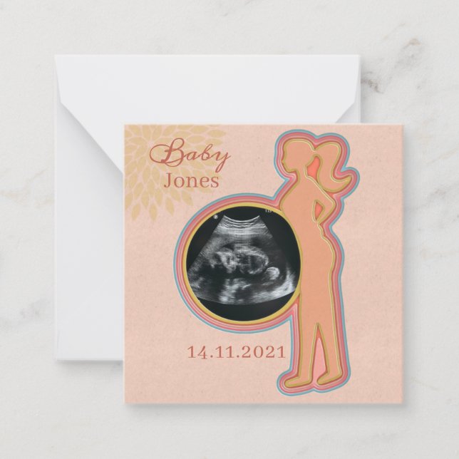 Carte De Correspondance Baby Ultrasound Keepsaké (Devant)