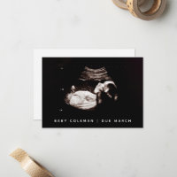 Révélation de grossesse Bébé Ultrasons Sonogramme