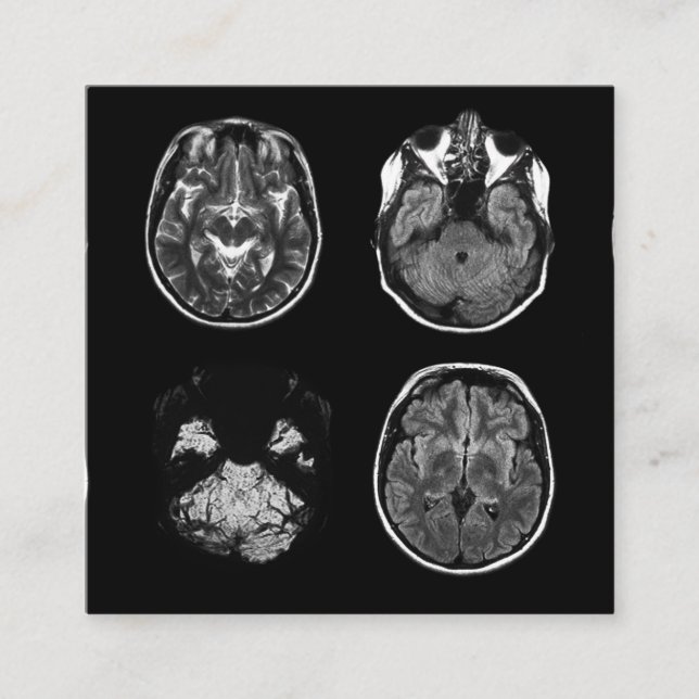 Carte De Visite Carré Analyse IRM du cerveau (Devant)