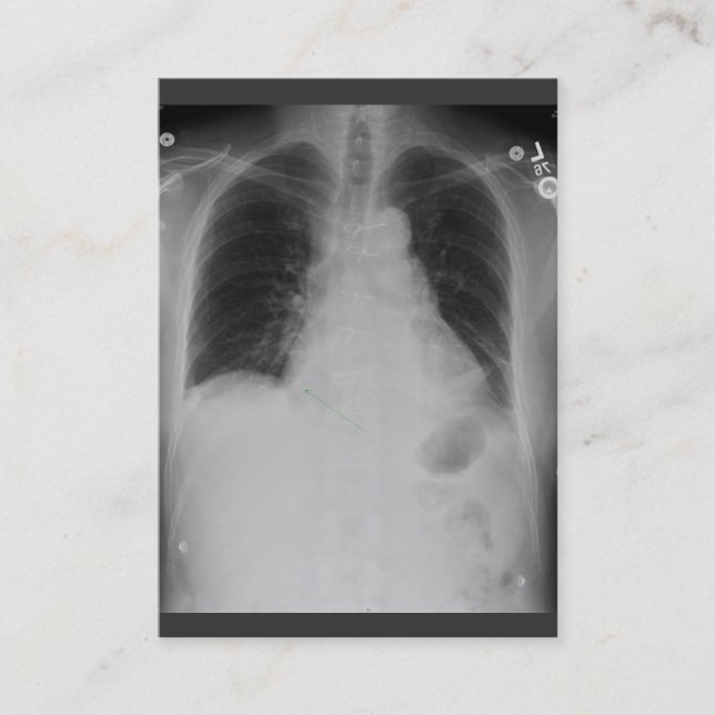 Carte De Visite ~ de rayon du coffre X potelé (Devant)