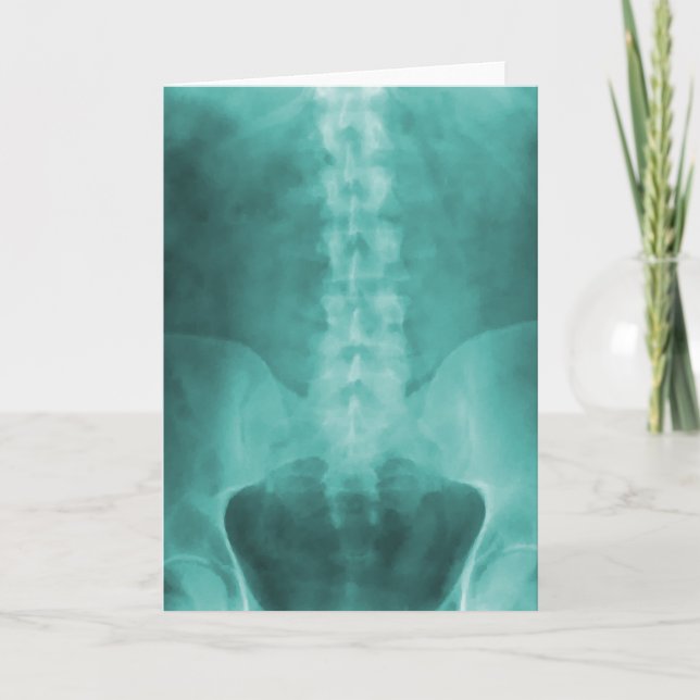 Carte de voeux d'art de rayon X de Digitals d'Aqua (Devant)