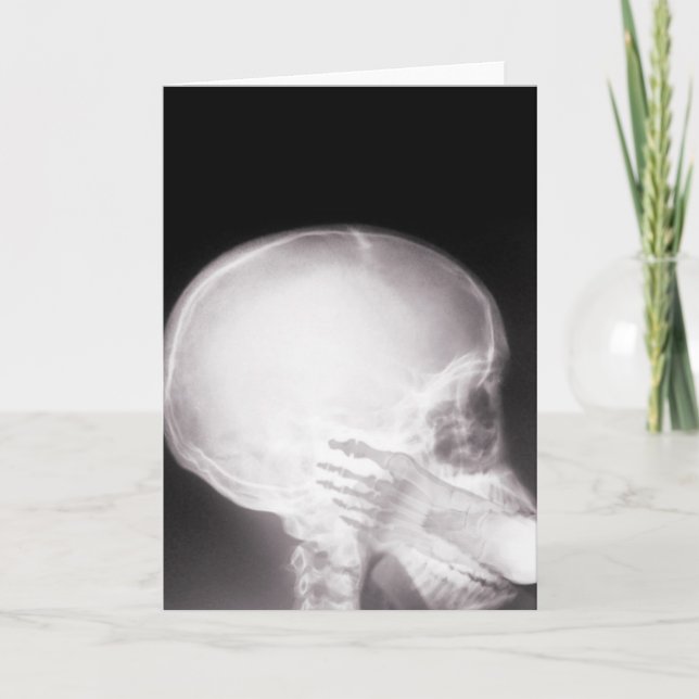 Carte Foot à Mouth X-Ray (Devant)