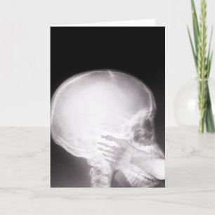 Carte Foot à Mouth X-Ray