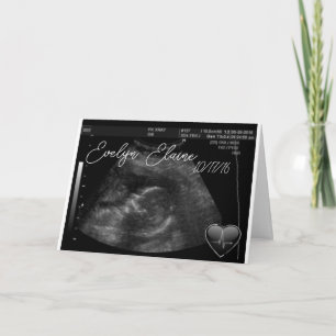 Carte Grossesse Sonogramme bébé mignon personnalisable