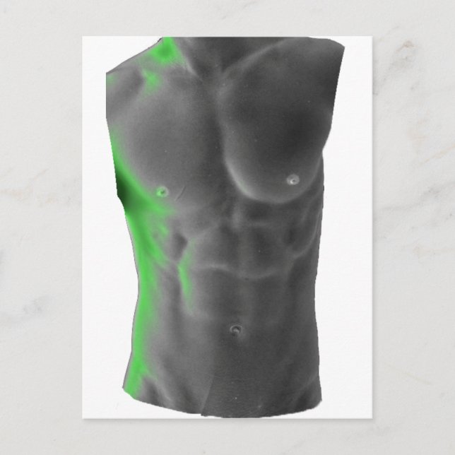 Carte Postale Abs (Devant)