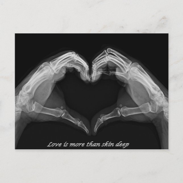 Carte Postale Art X-Ray (Devant)