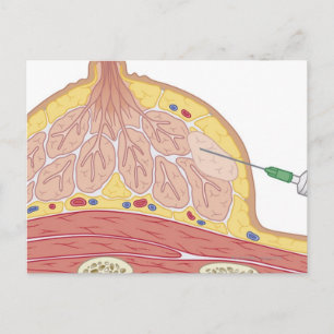 Carte Postale Aspiration fine des aiguilles