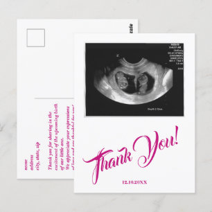 Carte Postale Baby shower Ultrasound fille Merci rose.