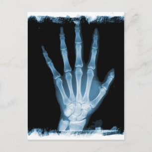 Carte Postale Bleu X-ray Squelette main