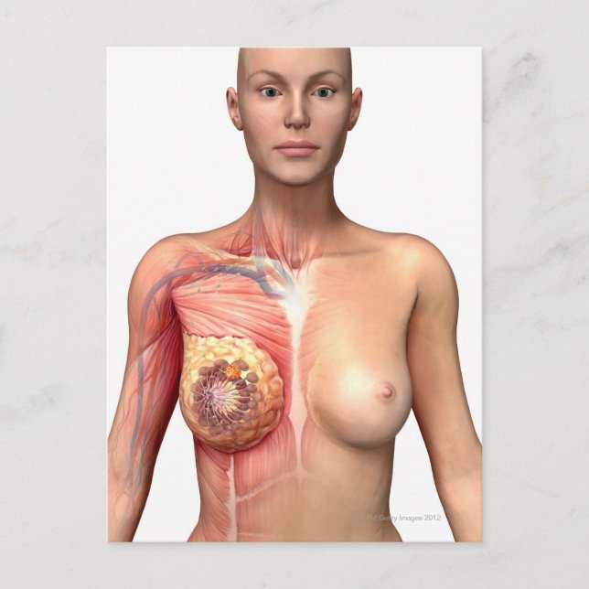 Carte Postale Cancer du sein (Devant)