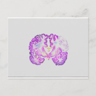 Carte Postale Cerveau