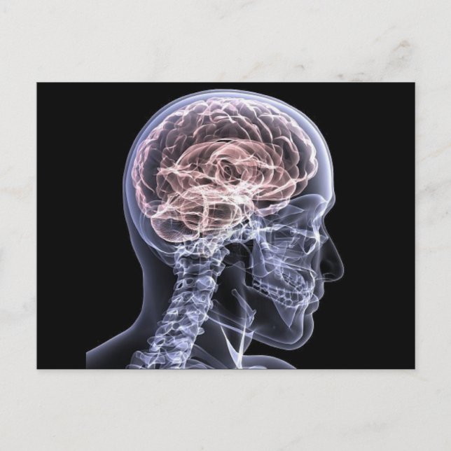 Carte Postale Cerveau X-Ray (Devant)