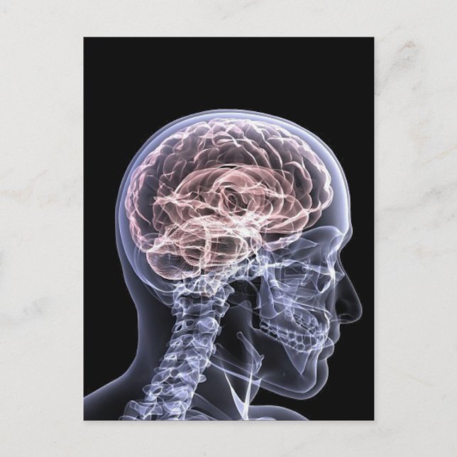 Carte Postale Cerveau X-Ray (Devant)