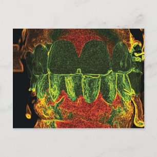 Carte Postale Dents folles Modèle Design Dentiste Orthodontiste 