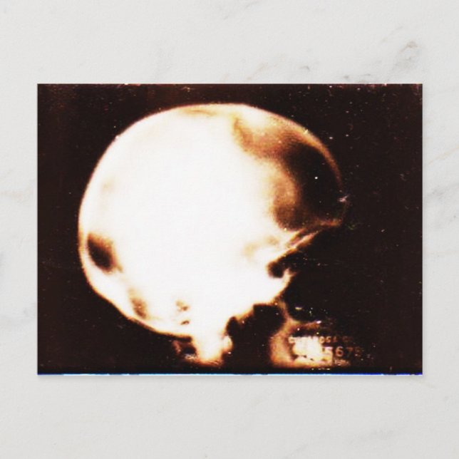 Carte Postale Empilé (Devant)