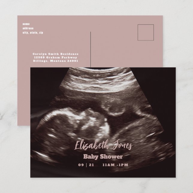 Carte Postale Faire-part Baby shower rose photo Ultrasound (Devant / Derrière)