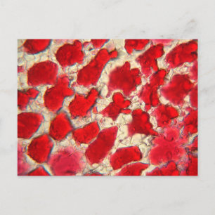 Carte Postale Feuille d'un rosier rouge au microscope