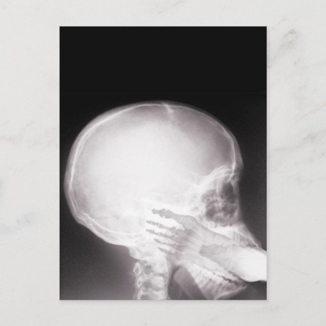 Carte Postale Foot à Mouth X-Ray (Devant)