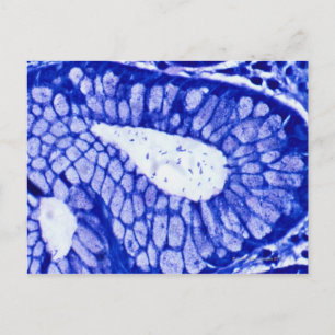 Carte Postale Helicobacter Pylori