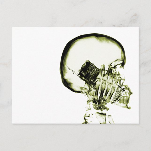 Carte Postale Iellow X-Ray Vision Skeleton (Devant)