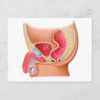 Illustration Médicale D'Une Fistule Rectouréthrale