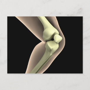 Carte Postale Image X-Ray Du Genou 2