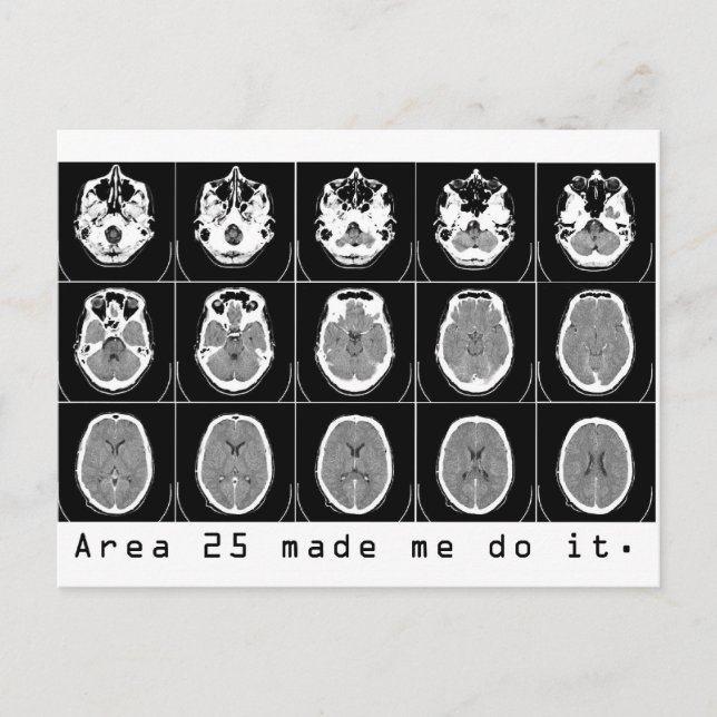 Carte Postale La zone 25 m'a fait le faire. (Devant)