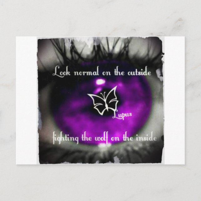 Carte Postale lupus eye22.jpg (Devant)
