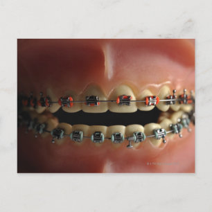 Carte Postale Modèle dentaire et bracelets de dents