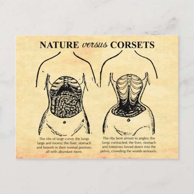 Carte Postale Nature contre Corsets (Devant)